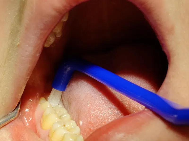 Visdomstand som bliver børstet med en solobørste