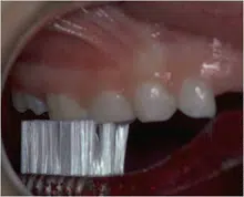 børstning af tænder